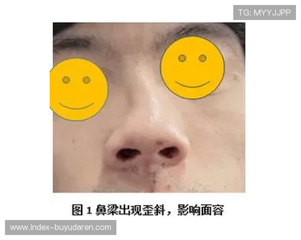 穆罕默德惨败伤情报告：眼眶骨折、鼻梁断裂与唇部撕裂